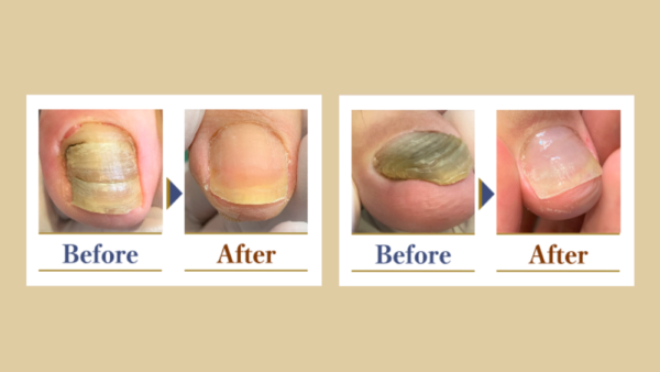 足爪が黄色い6つの原因とは？各症状への対処法とケア方法を解説