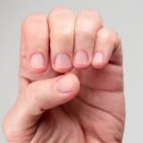 深爪とは？原因と対策を知り巻き爪などのトラブルを予防しよう