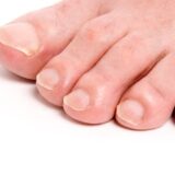 足の小指が痛い原因は「副爪」？対処法や正しい靴の選び方を解説