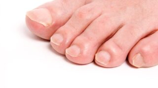 足の小指が痛い原因は「副爪」？対処法や正しい靴の選び方を解説