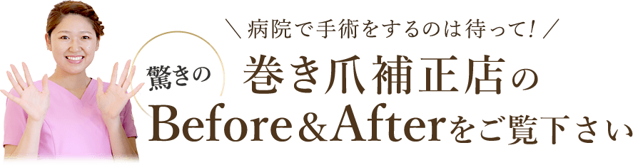 ビフォーアフターをご覧ください