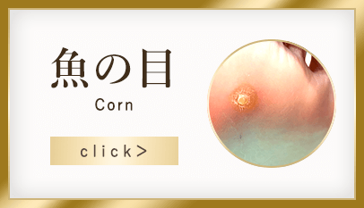 魚の目