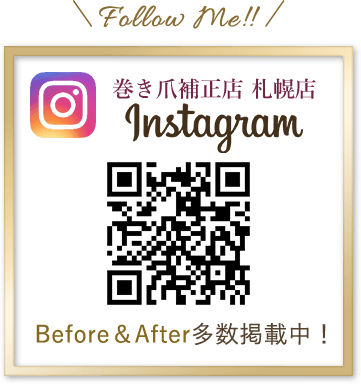 巻き爪補正店　札幌院インスタグラム