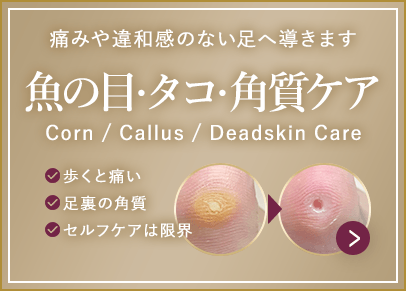 タコ。・角質ケア