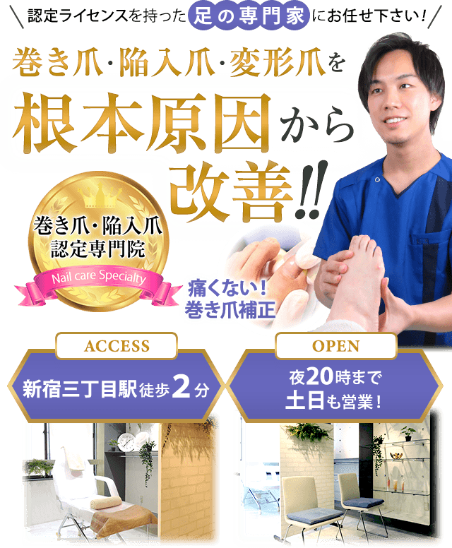 新宿区で巻き爪・陥入爪でお困りなら【新宿巻き爪補正店】ご相談ください！