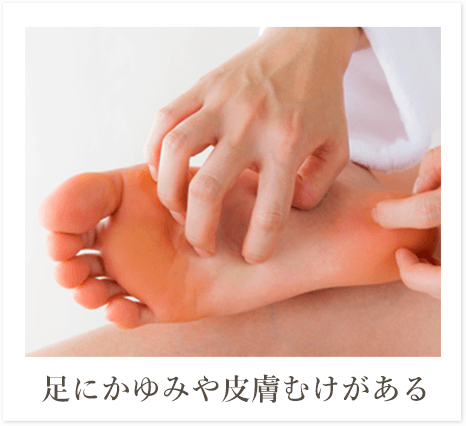 足にかゆみや皮膚むけがある