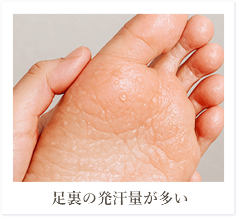足裏の発汗量が多い